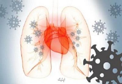 کووید ۱۹ موجب بروز فیبریلاسیون دهلیزی در بعضی بیماران می شود