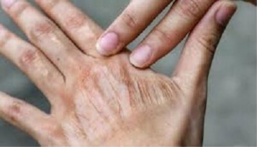 آیا کلاژن واقعا پوست را جوان می کنند؟