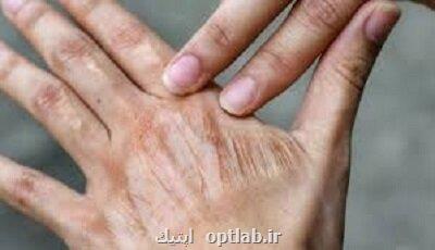 آیا کلاژن واقعا پوست را جوان می کنند؟