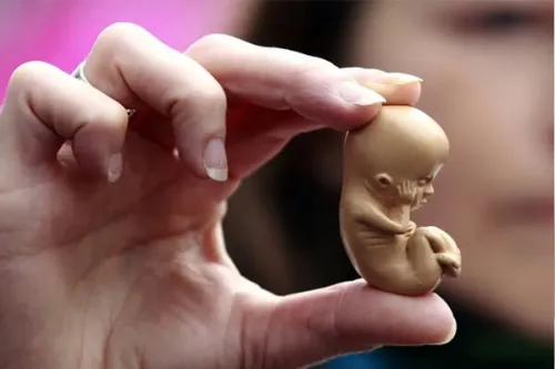 روزانه تا هزار سقط جنین در کشور آماری ۳۰ برابر تلفات تصادفات!