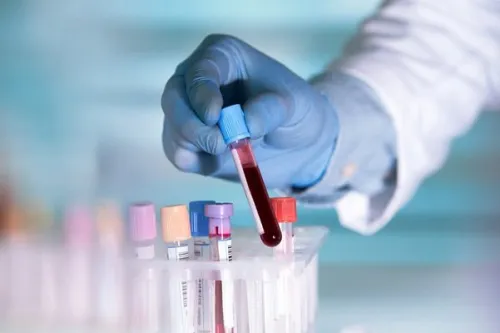 خطر HPV کاملا جدی است نگرانی یک ویروس شناس