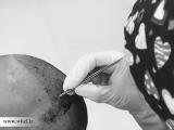 چند توصیه مهم بعد از كاشت مو