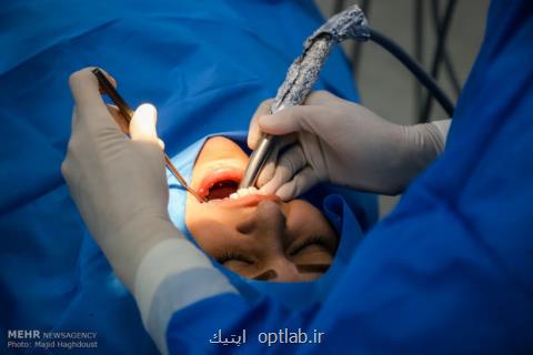 چرا دهان بوی بد می دهد، اهمیت جرم گیری دندان ها