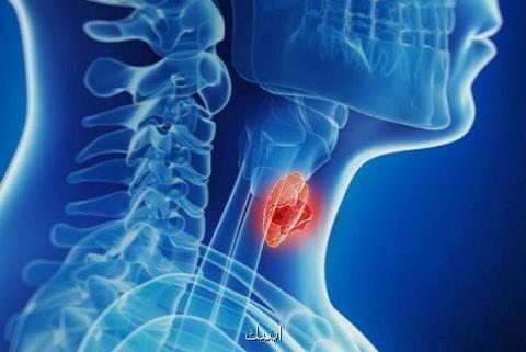 روشی نوین برای انجام عمل جراحی تیرویید بدون جای زخم