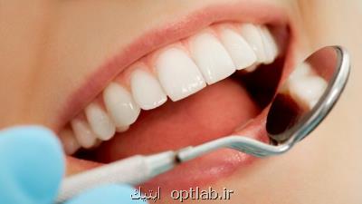 الگوبرداری این دفعه از لمینت دندان سلبریتی ها!